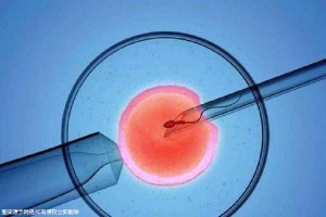 供卵代怀代生机构